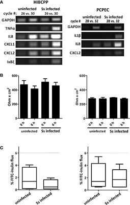 A Comparative Transcriptome Analysis of Human and Porcine Choroid Plexus Cells in Response to Streptococcus suis Serotype 2 Infection Points to a Role of Hypoxia